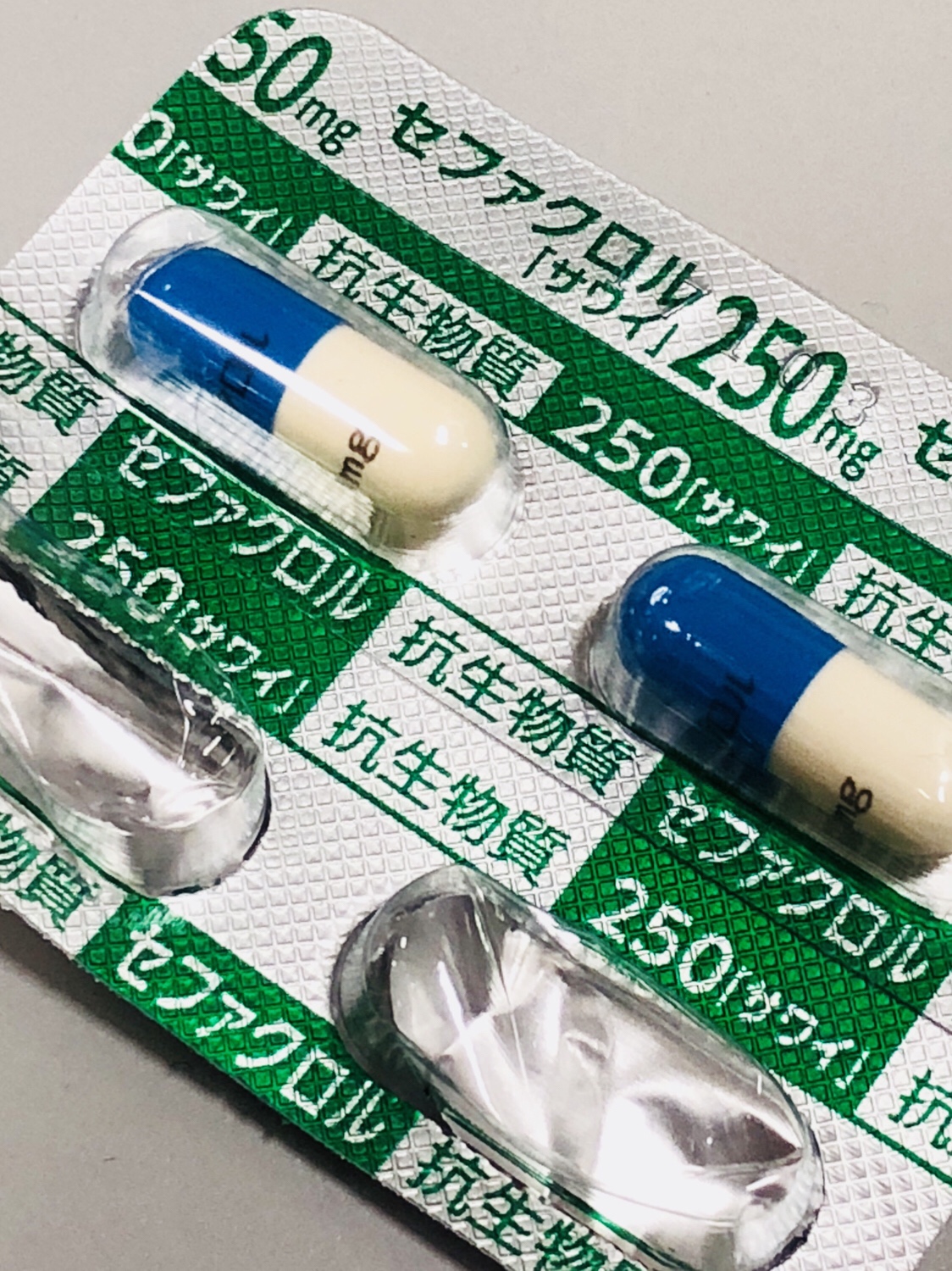 【後頭部】痛いシコリ？コブ？ 粉瘤を切らずに薬で治した話【大人】
